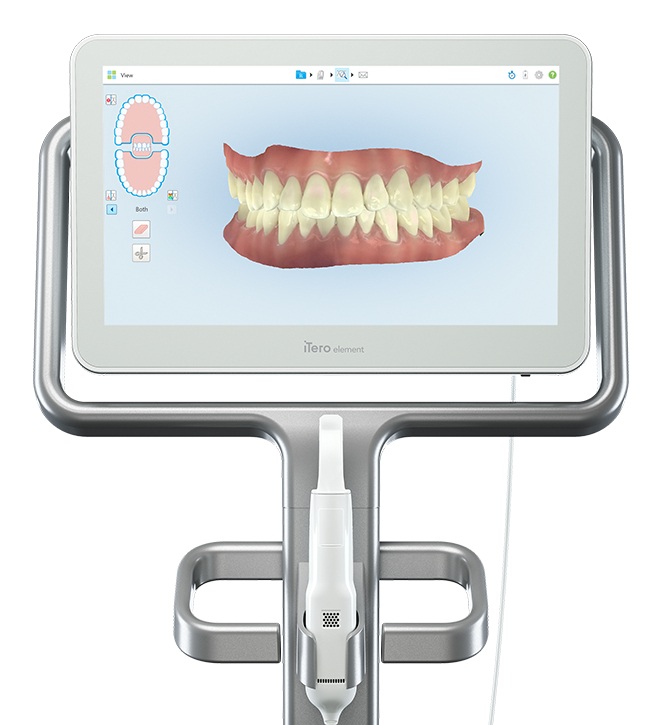 Invisalign-Itero-dental-care-arlington-heights Invisalign-Itero-dental-care-arlington-heights