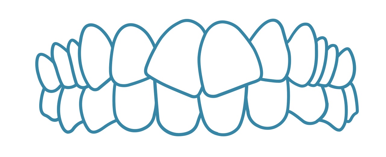 Invisalign-generally-striaght-teeth-dental-care-arlington-heights Invisalign-generally-striaght-teeth-dental-care-arlington-heights