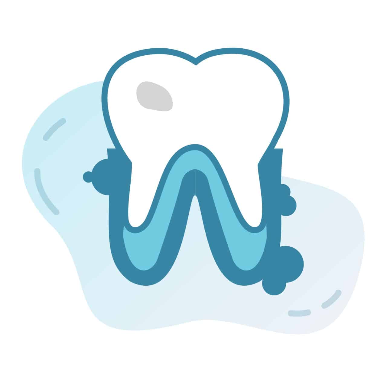 dental-care-arlington-heights-dental-services-gum-disease dental-care-arlington-heights-dental-services-gum-disease
