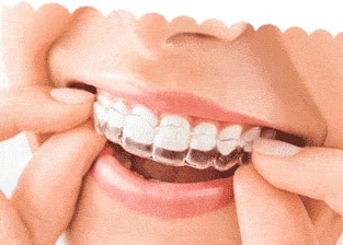 dentist-near-me-huntley-invisalign-dental-care-arlington-heights