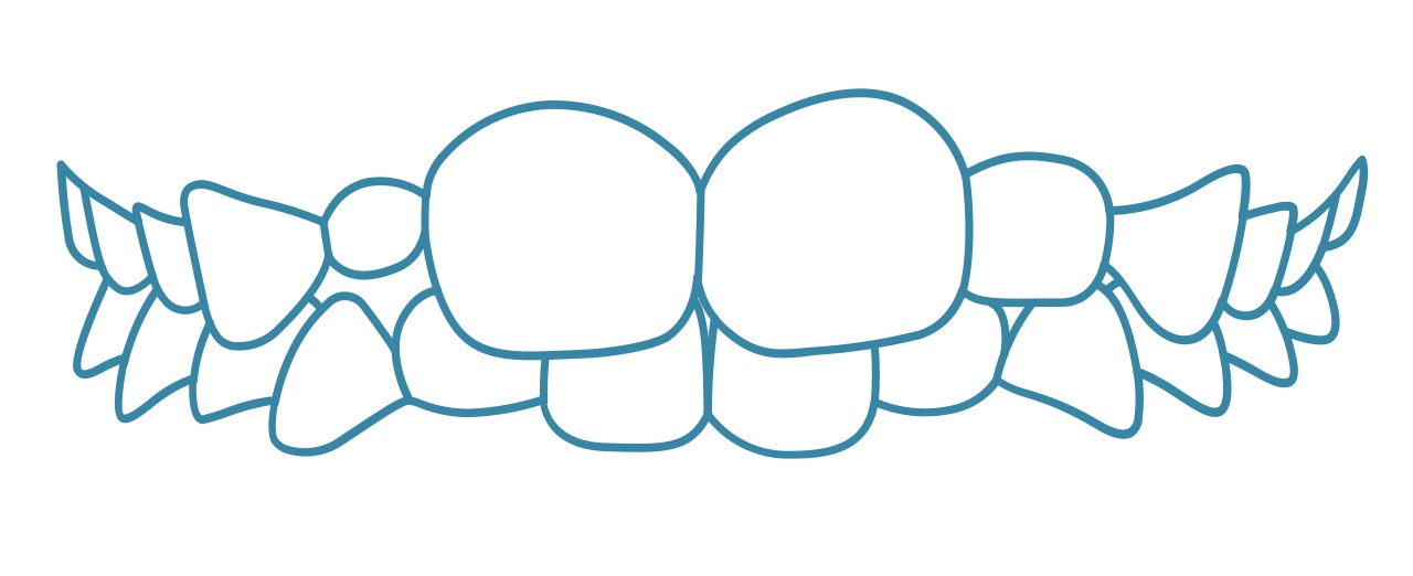 invisalign-mixed-baby-teeth-permanent-teeth-dental-care-arlington-heights invisalign-mixed-baby-teeth-permanent-teeth-dental-care-arlington-heights